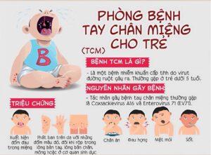 nguyên nhân bệnh tay chân miệng