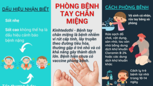 bệnh tay chân miệng ở trẻ em